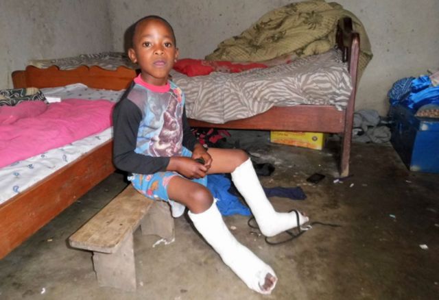 Kinder mit Behinderungen führen in Uganda ein schweres Leben. Sie gelten als verflucht und werden aus Angst und Scham häufig sich selbst überlassen. © Perspektive für Kinder